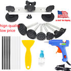 Us0751570468409 Pdr Paintless Dent Repair 751570468409